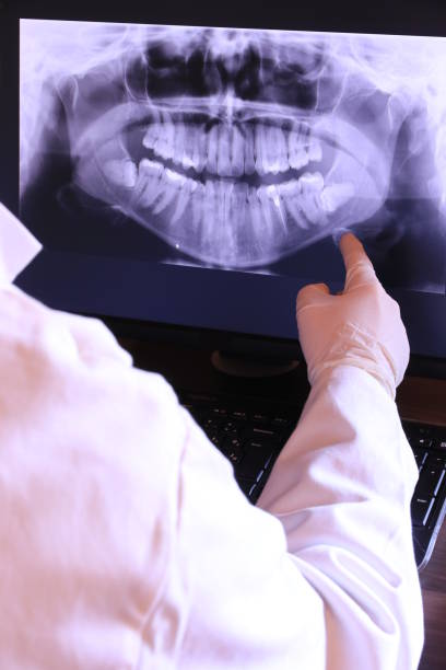 Best Knocked-Out Tooth (Avulsed Tooth) Treatment in Freeland, MI